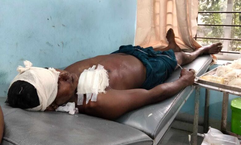 রাজবাড়ীতে হাটের ইজারা বিরোধে তিনজনকে কুপিয়ে জখম রাজবাড়ীতে হাটের ইজারা বিরোধে তিনজনকে কুপিয়ে জখম