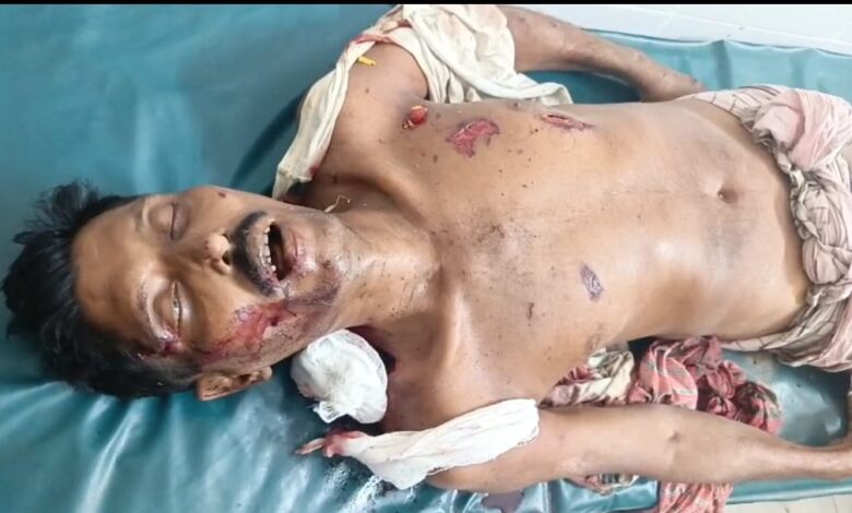 ঈদের নামাজ নিয়ে বিরোধে শার্শায় বোমা হামলা: বিএনপি সদস্য নিহত, আহত-১ ঈদের নামাজ নিয়ে বিরোধে শার্শায় বোমা হামলা: বিএনপি সদস্য নিহত, আহত-১