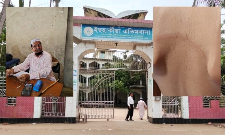 দাগনভূঞার ইসাকিয়া এতিমখানা মাদ্রাসা-য় শিশুর ওপর নির্যাতনের অভিযোগ